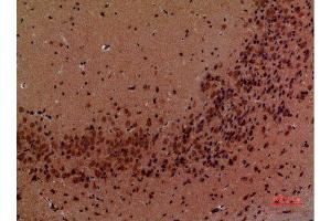 Immunohistochemistry (IHC) image for anti-Arginine (ARG) (Internal Region) antibody (ABIN3187869)