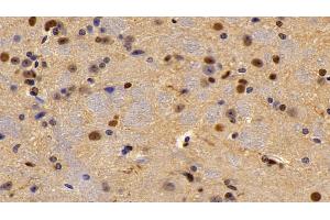 Detection of LXRb in Mouse Spinal cord Tissue using Polyclonal Antibody to Liver X Receptor Beta (LXRb)