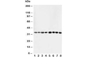 Western blot testing of AIMP2 antibody and Lane 1:  rat liver;  2: rat lung;  3: rat kidney;  4: rat brain;  5: Jurkat;  6: CEM;  7: HUT;  8: U93T;  10: U93T cell lysate (AIMP2 抗体  (AA 298-320))