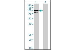 Western Blotting (WB) image for anti-Oculocerebrorenal Syndrome of Lowe (OCRL) (AA 146-240) antibody (ABIN782420) (OCRL 抗体  (AA 146-240))
