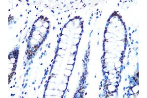 Immunohistochemistry of paraffin-embedded human colon using DYNLL1 Rabbit mAb (ABIN7266864) at dilution of 1:100 (40x lens).