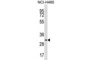 TMIGD2 Antibody (Center) (ABIN1881890 and ABIN2839020) western blot analysis in NCI- cell line lysates (35 μg/lane). (TMIGD2 抗体  (AA 119-147))