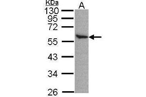 Western Blotting (WB) image for anti-Aldehyde Dehydrogenase 2 Family (Mitochondrial) (ALDH2) (Center) antibody (ABIN2855041)