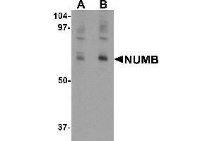 Western blot analysis of NUMB in mouse lung tissue lysate with NUMB antibody at (A) 0. (NUMB 抗体  (C-Term))
