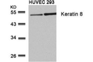 Image no. 3 for anti-Keratin 8 (KRT8) (Ser73) antibody (ABIN197582) (KRT8 抗体  (Ser73))