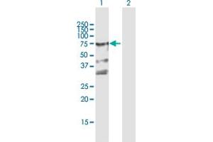 Western Blot analysis of ZYX expression in transfected 293T cell line by ZYX MaxPab polyclonal antibody. (ZYX 抗体  (AA 1-572))