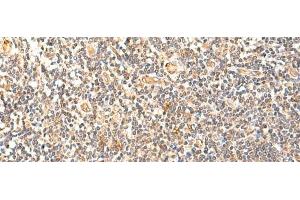 Immunohistochemistry of paraffin-embedded Human tonsil tissue using GPD1L Polyclonal Antibody at dilution of 1:60(x200) (GPD1L 抗体)