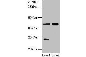 Western blot All lanes: MAP2K3 antibody at 10 μg/mL Lane 1: RAW264. (MAP2K3 抗体  (AA 1-347))