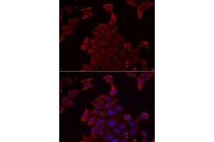 Immunofluorescence analysis of MCF7 cells using PDHX antibody. (PDHX 抗体  (AA 1-300))