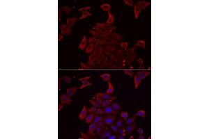 Immunofluorescence analysis of MCF7 cells using PDHX antibody. (PDHX 抗体  (AA 1-300))