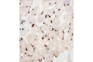 Immunohistochemistry (Paraffin-embedded Sections) (IHC (p)) image for anti-Peroxisome Proliferator-Activated Receptor alpha (PPARA) (AA 1-468) antibody (ABIN1944858)