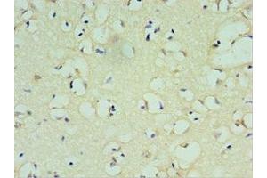Immunohistochemistry of paraffin-embedded human brain tissue using ABIN7172637 at dilution of 1:100 (SOX6 抗体  (AA 1-74))