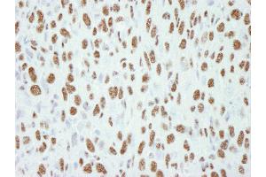 Immunohistochemistry (IHC) image for anti-Transcription Elongation Regulator 1 (TCERG1) (AA 1-50) antibody (ABIN7448453) (TCERG1 抗体  (AA 1-50))