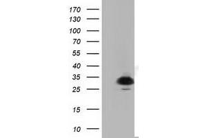 Western Blotting (WB) image for anti-Pyrroline-5-Carboxylate Reductase Family, Member 2 (PYCR2) antibody (ABIN1499983) (PYCR2 抗体)