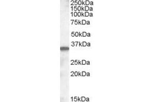 Western Blotting (WB) image for anti-Solute Carrier Family 10 (Sodium/bile Acid Cotransporter Family), Member 2 (SLC10A2) (AA 337-348) antibody (ABIN343101) (SLC10A2 抗体  (AA 337-348))