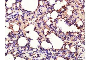 Paraformaldehyde-fixed, paraffin embedded rat lung tissue, Antigen retrieval by boiling in sodium citrate buffer(pH6) for 15min, Block endogenous peroxidase by 3% hydrogen peroxide for 30 minutes, Blocking buffer (normal goat serum) at 37°C for 20min, Antibody incubation with Rabbit Anti-Calpain 1 Polyclonal Antibody, Unconjugated  at 1:400 overnight at 4°C, followed by a conjugated secondary and DAB staining