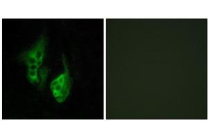 Immunofluorescence analysis of HeLa cells, using OPN5 antibody. (OPN5 抗体  (C-Term))