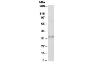 Western blot testing of human colon lysate with Caspase 6 antibody at 0. (Caspase 6 抗体)