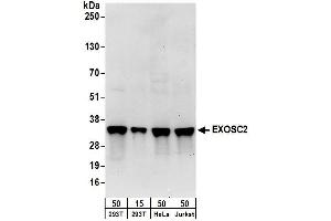 anti-Exosome Component 2 (EXOSC2) (AA 243-293) antibody