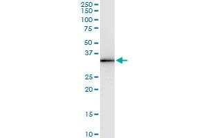 Immunoprecipitation (IP) image for anti-Centromere Protein H (CENPH) (AA 1-247) antibody (ABIN528746)