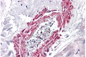 Human Heart, Vessel: Formalin-Fixed, Paraffin-Embedded (FFPE)