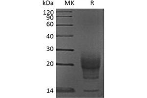 Western Blotting (WB) image for Interleukin 5 (IL5) protein (His tag) (ABIN7320883) (IL-5 Protein (His tag))