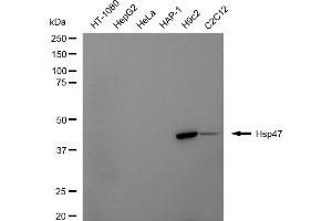 Western blotting analysis using Hsp47 antibody (ABIN7800316).