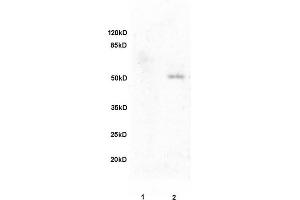 L1 rat brain, L2 human colon carcinoma lysates probed (ABIN728473) at 1:200 in 4 °C. (Fibulin 5 抗体  (AA 101-200))
