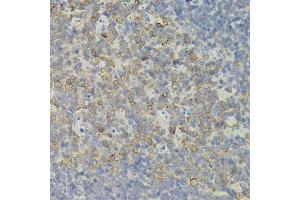 Immunohistochemistry of paraffin-embedded mouse spleen using IRF1 antibody. (IRF1 抗体)
