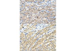 Immunohistochemical staining (Formalin-fixed paraffin-embedded sections) of (A) and (B) human heart with MBNL1 polyclonal antibody . (MBNL1 抗体  (AA 211-260))