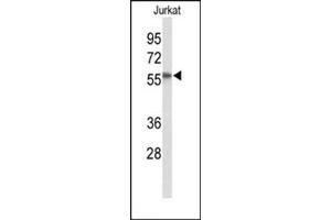 Western Blotting (WB) image for anti-SAC1 Suppressor of Actin Mutations 1-Like (SACM1L) (AA 415-444), (C-Term) antibody (ABIN954662)