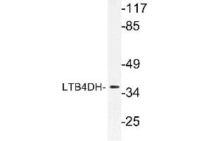 Western blot (WB) analysis of LTB4DH antibody in extracts from HT-29 cells. (PTGR1 抗体)