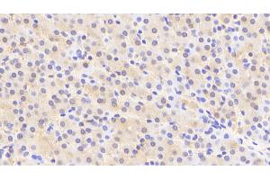 Detection of ACY1 in Human Liver Tissue using Polyclonal Antibody to Aminoacylase 1 (ACY1) (Aminoacylase 1 抗体  (AA 2-408))