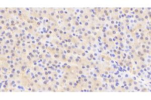 Detection of ACY1 in Human Liver Tissue using Polyclonal Antibody to Aminoacylase 1 (ACY1) (Aminoacylase 1 抗体  (AA 2-408))