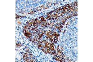 Immunohistochemistry of paraffin-embedded Rat ovary using PIGU Rabbit pAb (ABIN7269291) at dilution of 1:100 (40x lens). (PIGU 抗体)