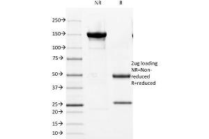 SDS-PAGE Analysis of Purified Cytokeratin 8 Mouse Monoclonal Antibody (KRT8/803). (KRT8, KRT18 抗体)
