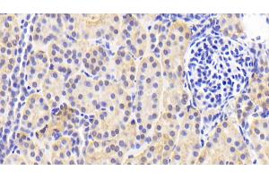 Detection of PRDX4 in Human Kidney Tissue using Polyclonal Antibody to Peroxiredoxin 4 (PRDX4) (Peroxiredoxin 4 抗体  (AA 6-249))