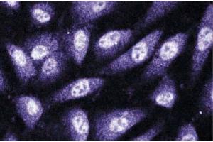 Immunofluorescence staining of human endothelial cells. (CNKSR1 抗体  (AA 10-217))