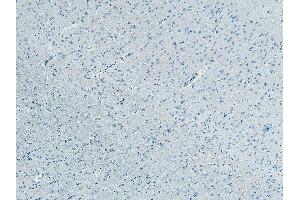 ABIN185053 Negative Control showing staining of paraffin embedded Human Cortex, with no primary antibody. (FBXL2 抗体  (N-Term))