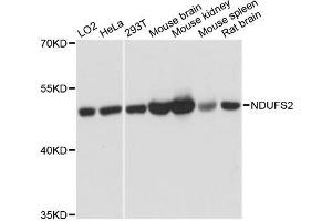 Western blot analysis of extracts of various cell lines, using NDUFS2 antibody. (NDUFS2 抗体  (AA 204-463))