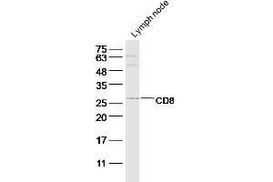 Mouse lymph node lysate probed with CD8a Polyclonal Antibody at 1:300 overnight in 4˚C. (CD8 抗体  (AA 101-200))