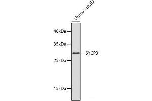 Western blot analysis of extracts of Human testis using SYCP3 Polyclonal Antibody. (SYCP3 抗体)