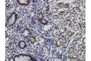 Image no. 1 for anti-Transcriptional Adaptor 2B (TADA2B) (AA 2-111) antibody (ABIN466261) (TADA2B 抗体  (AA 2-111))