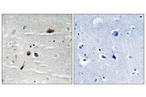 Immunohistochemistry (IHC) image for anti-Mdc1 (MDC1) (pSer513) antibody (ABIN1847790) (MDC1 抗体  (pSer513))