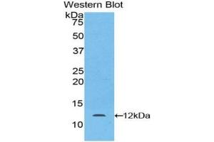 Detection of Recombinant LAMb2, Mouse using Polyclonal Antibody to Laminin Beta 2 (LAMb2) (LAMB2 抗体  (AA 1176-1309))
