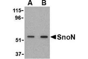 Western Blotting (WB) image for anti-SKI-Like Oncogene (SKIL) (N-Term) antibody (ABIN1031579)