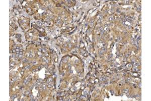 IHC analysis of Pyrin/MEFV using anti-Pyrin/MEFV antibody (ABIN7601809). (MEFV 抗体  (AA 463-781))