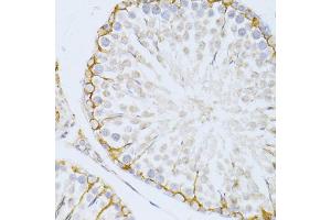 Immunohistochemistry of paraffin-embedded rat testis using PIKFYVE antibody (ABIN5974035) at dilution of 1/100 (40x lens). (PIKFYVE 抗体)