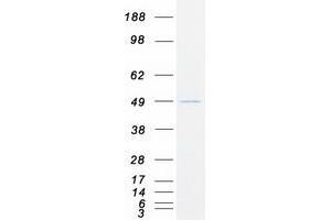 Validation with Western Blot