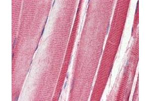Immunohistochemical analysis of paraffin-embedded human skeletal musle tissues using DDR2 mouse mAb. (DDR2 抗体)